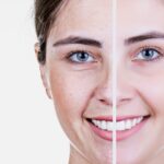 Facials (Anti-Aging)