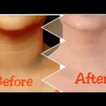 NECK BLEACHING/ تشقير رقب