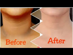 NECK BLEACHING/ تشقير رقب