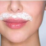 UPPERLIP BLEACHING/ شنب تشقي